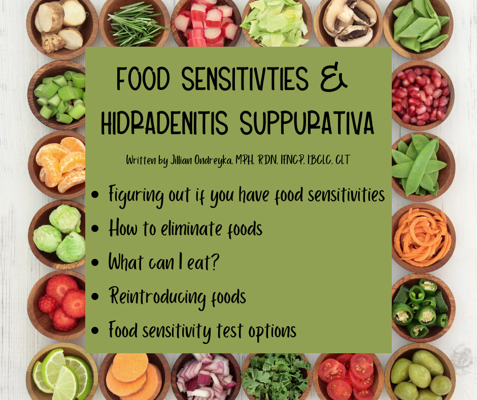 Effective Ways to Choose PetSmart Hill's Science Diet for Your Pets in 2025